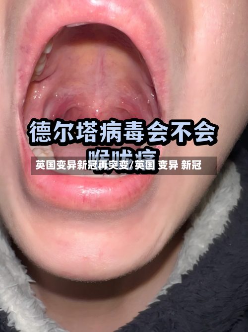英国变异新冠再突变/英国 变异 新冠