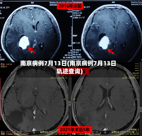 南京病例7月13日(南京病例7月13日轨迹查询)-第3张图片